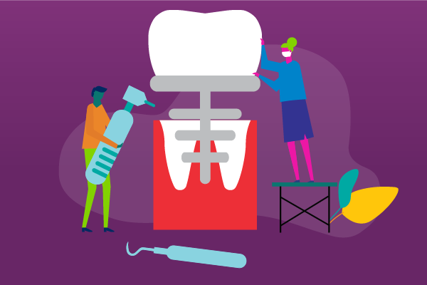 full mouth dental implants cost